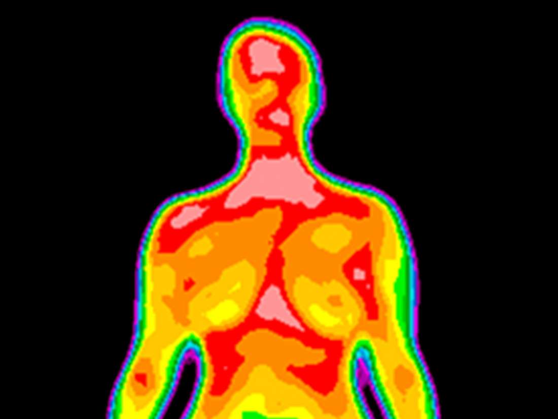 Breast Thermography What To Expect Benefits And Risks