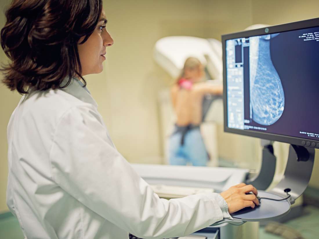 Breast Calcifications Causes When To See A Doctor And Diagnosis