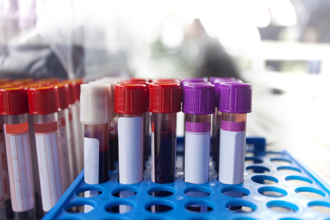 Blood tests are a method of diagnosis for peptic ulcers.