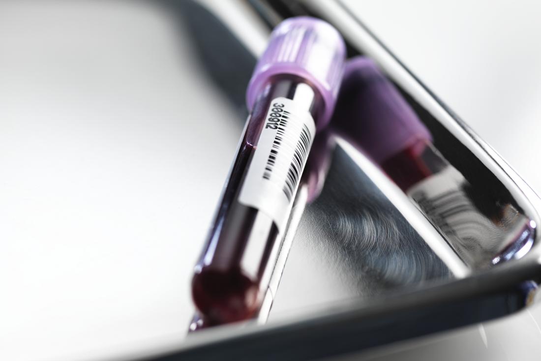 Blood tests for schizophrenia