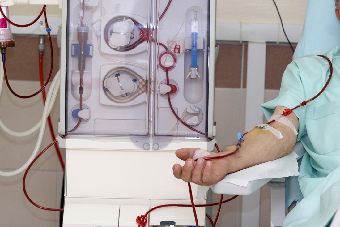 hemodialysis