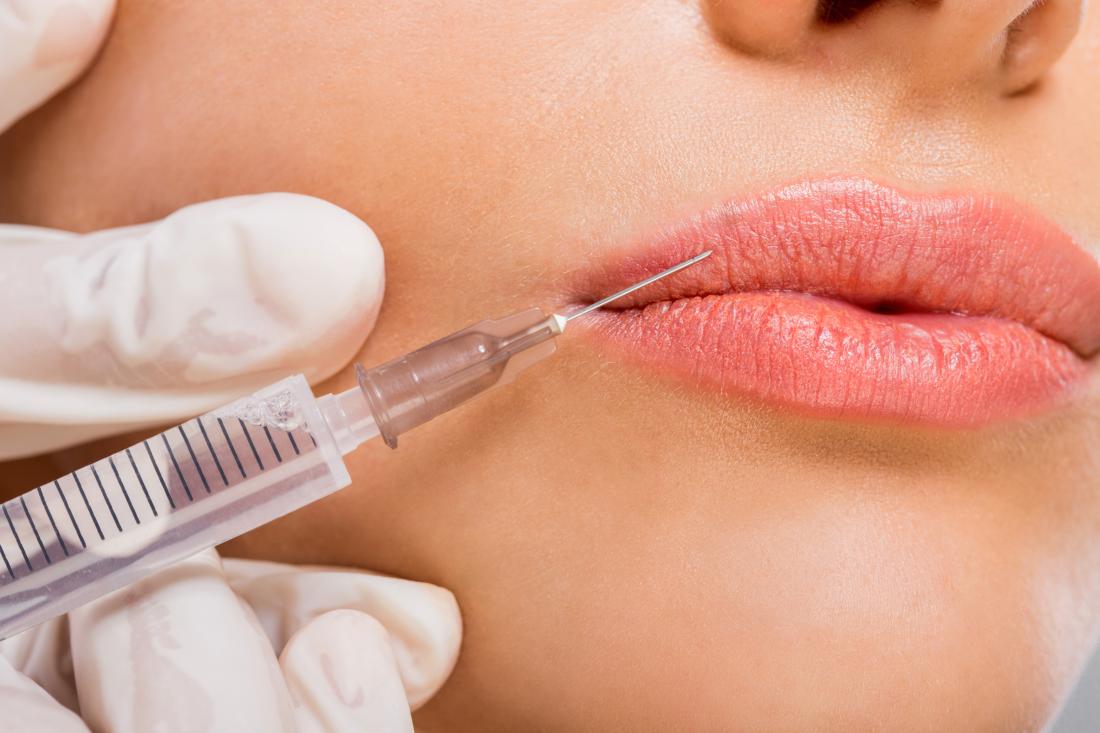 Aesthetic Injectable Services