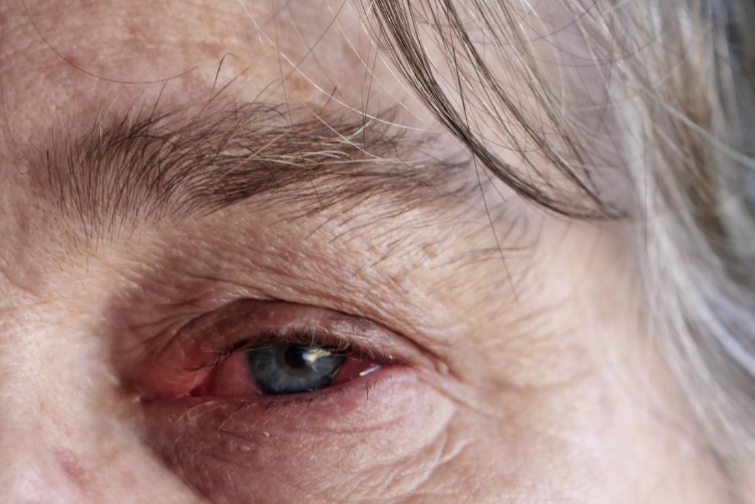 Inflammation can result from different kinds of bacteria or viruses.