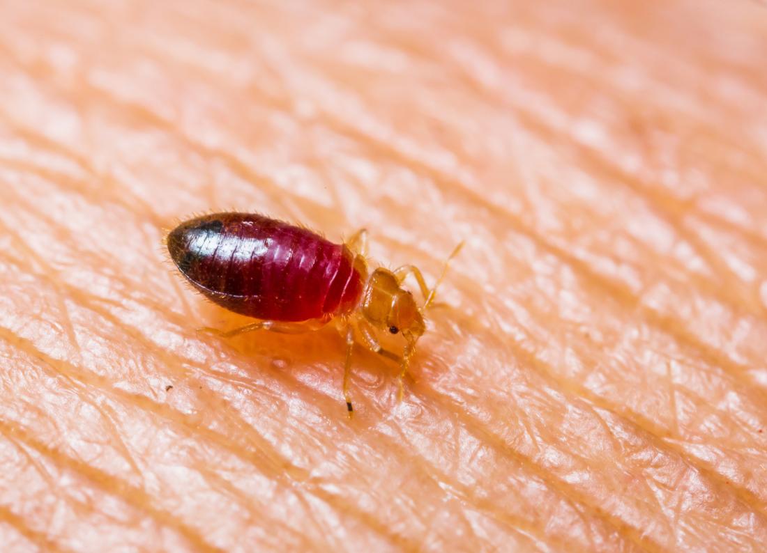 Bedbugs Symptoms Treatment And Removal