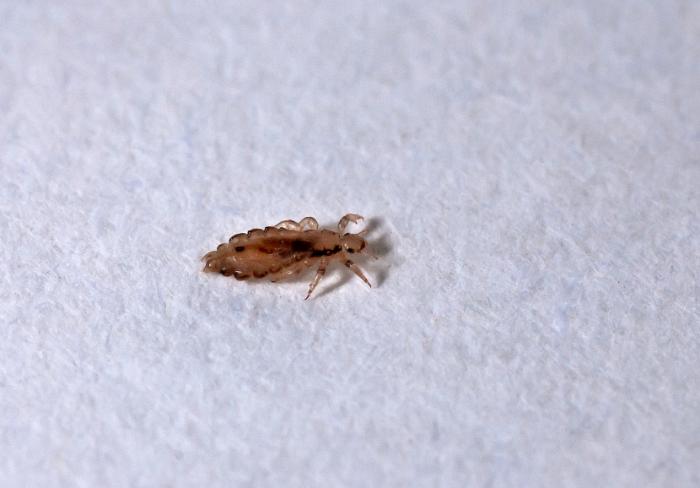 Head lice Causes symptoms and treatments