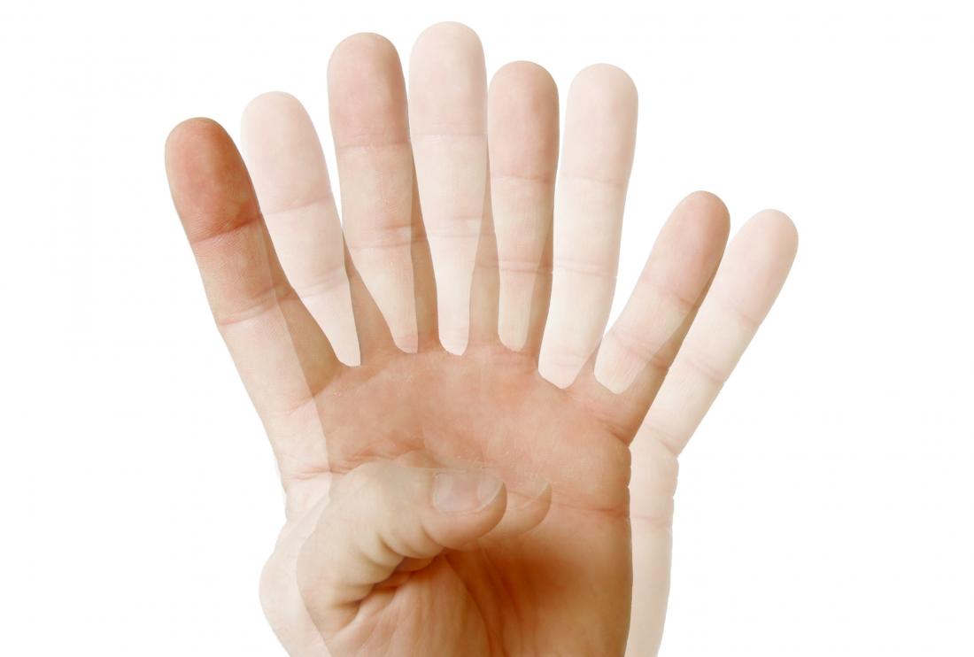 Double Vision Diplopia Causes Diagnosis And Treatment