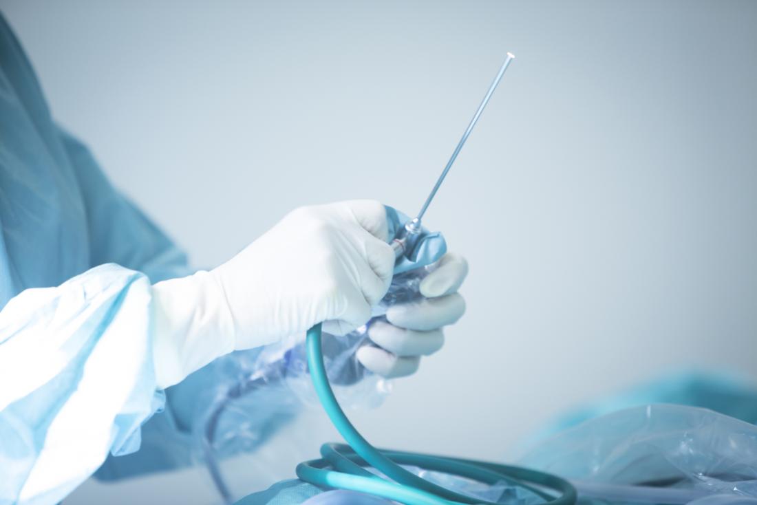 endoscope<!--mce:protected %0A-->