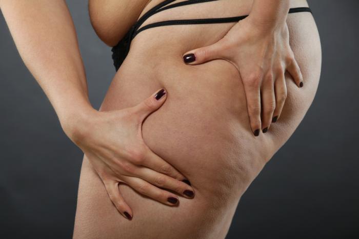 Liposuction