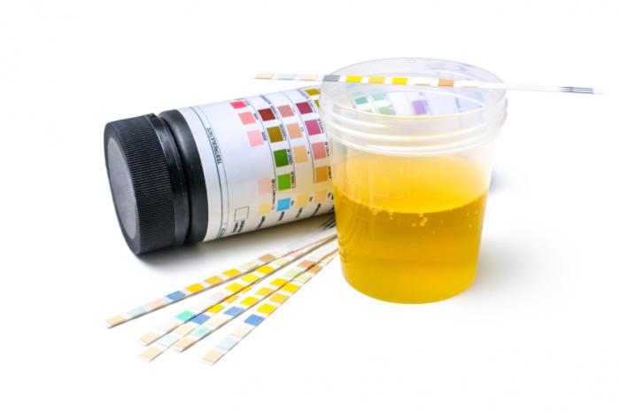 Urine sample and testing strips.