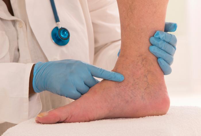 Clinical clanger: 'My ankles are really swollen, doctor – can you give me  some of those water tablets?' - Pulse Today