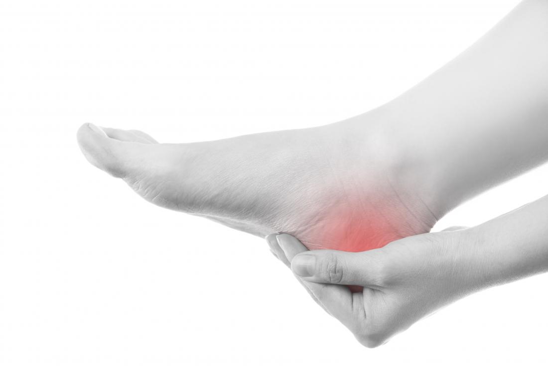 Arthritis In Back Of Heel at Edward Corey blog