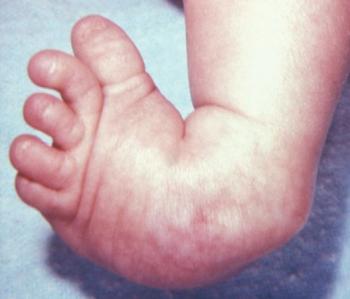 Severed Baby Foot Not Actually a Babys Foot