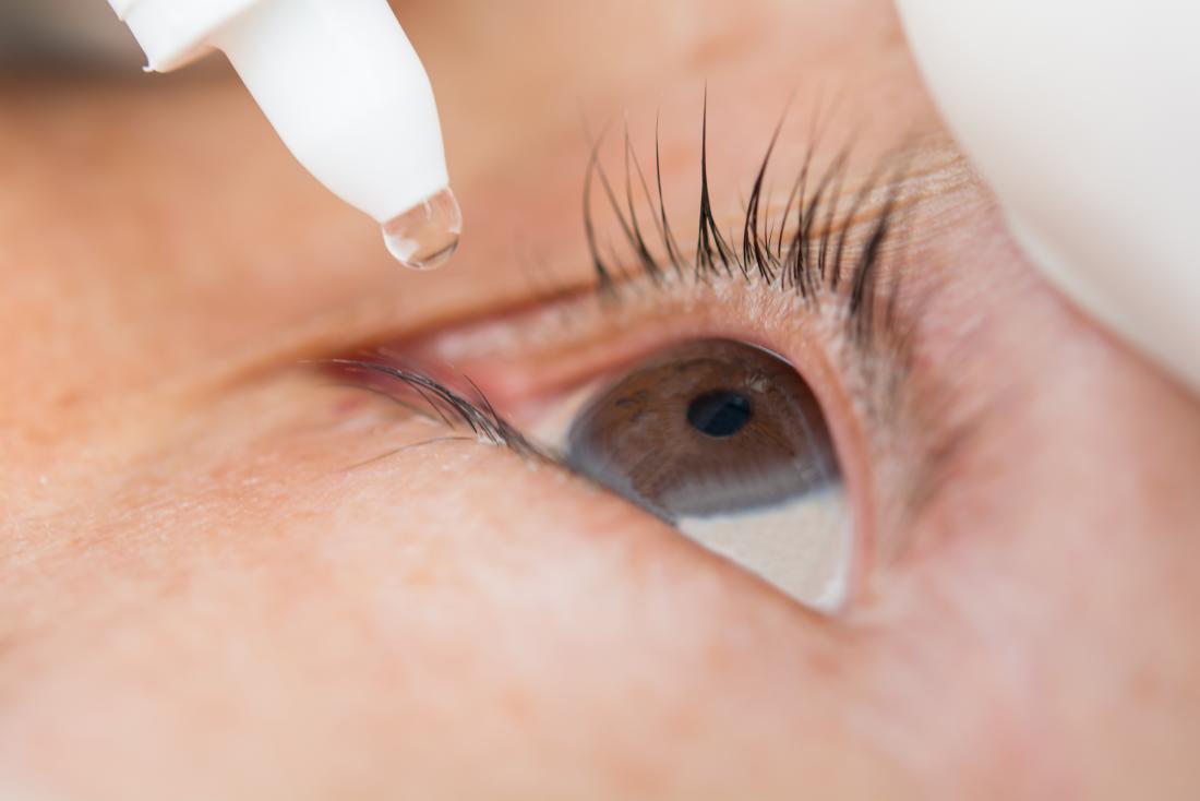 Blepharitis from Eyelash Extensions: Tips & Relief - CorneaCare