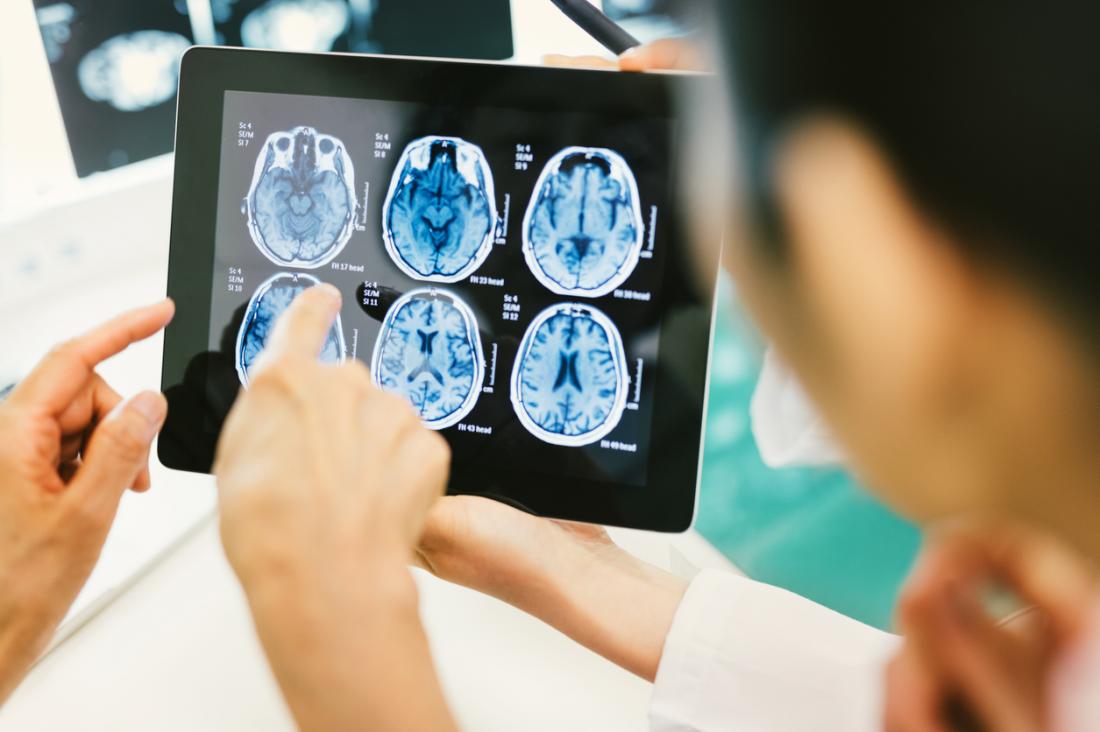 Pinpointing the cause of a brain abscess will lead to more effective treatment.