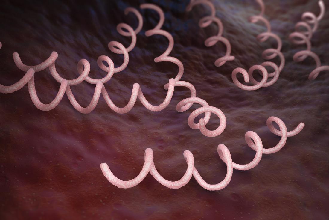 Syphilis Causes, risk factors, symptoms, and treatment