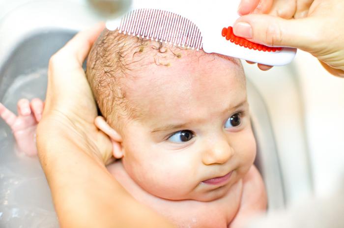 baby hair shampoo for cradle cap