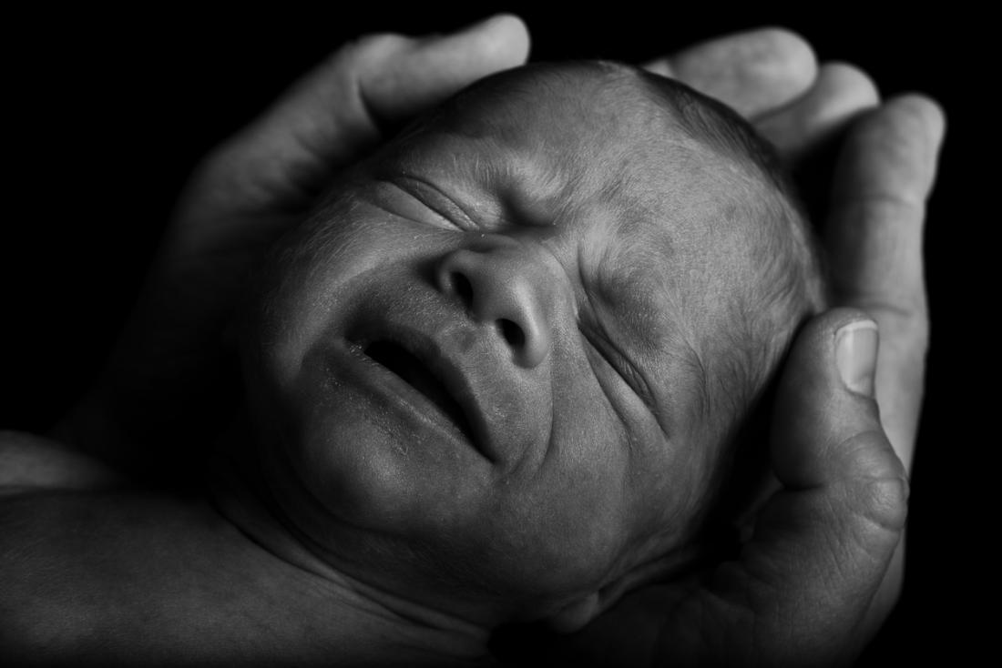 Vitamin A deficiency preterm infants