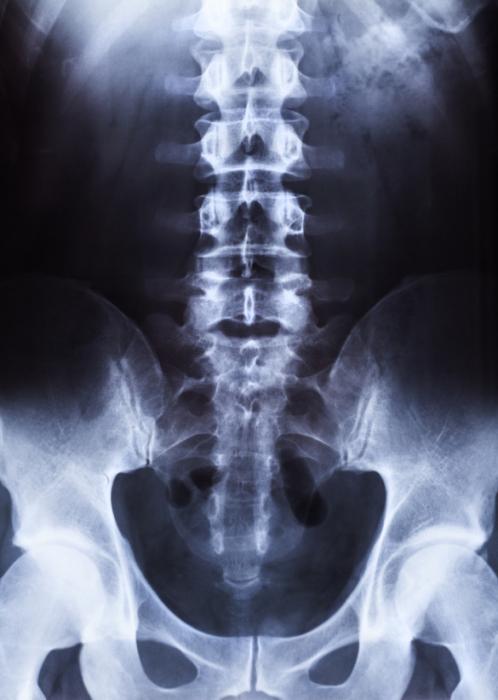 X-rays: Overview, side effects, risks, and more