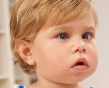 Cross-Eyed Baby (Strabismus): Causes and Treatment