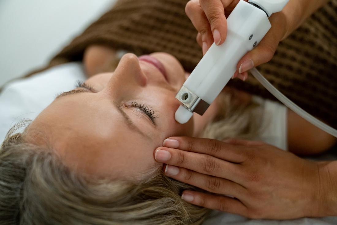 laser treatment