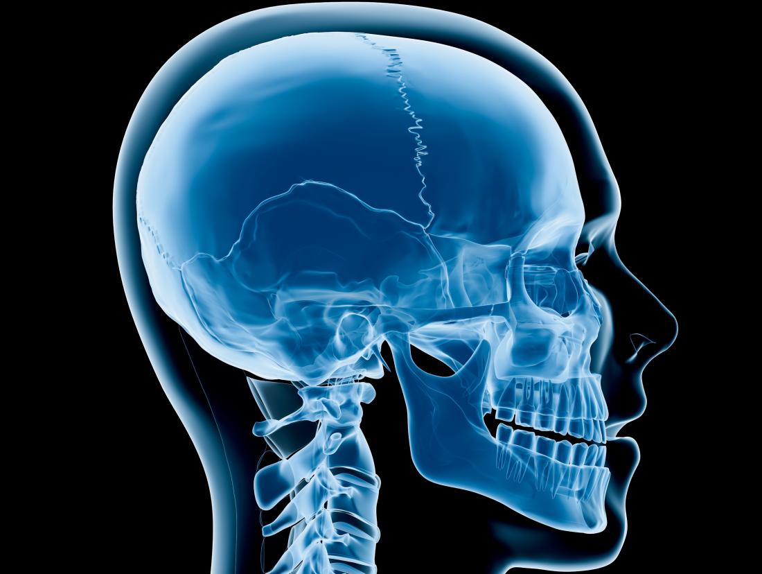 lambdoid suture x ray