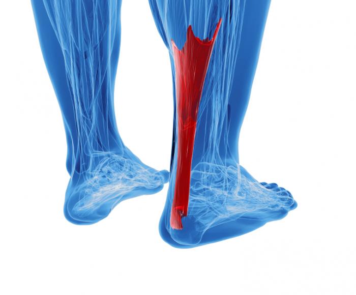 heel wedges for achilles tendonitis
