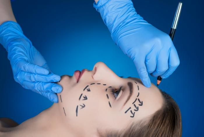 Facelift: What to expect and possible complications