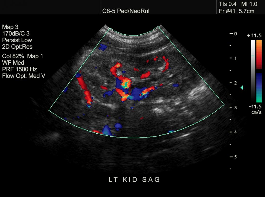 Ultrasonography