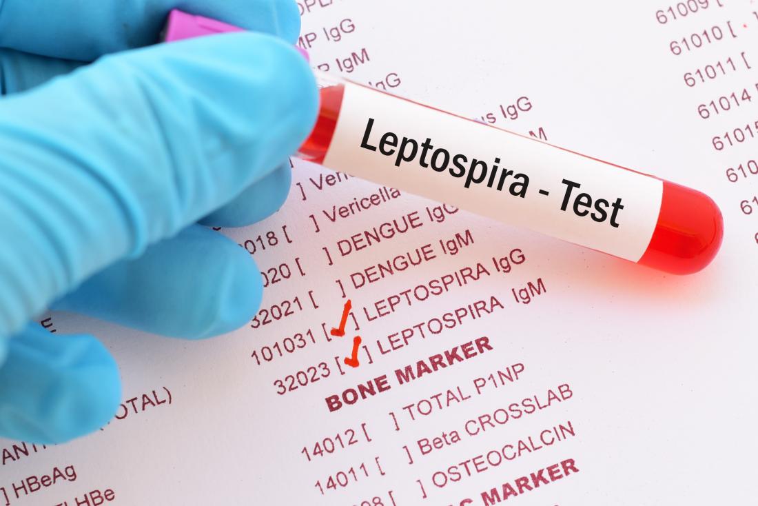 Leptospirosis: Treatment, symptoms, and types