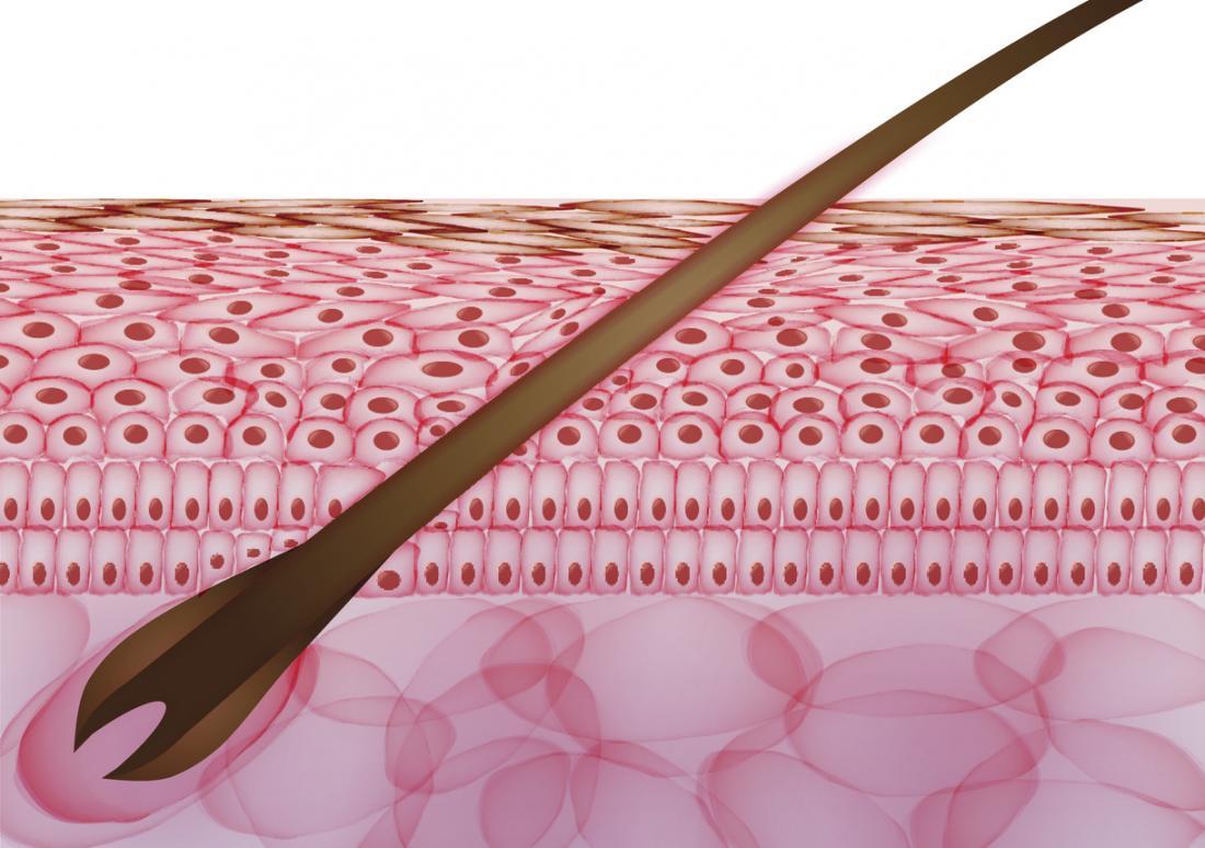 ヘアダイアグラム