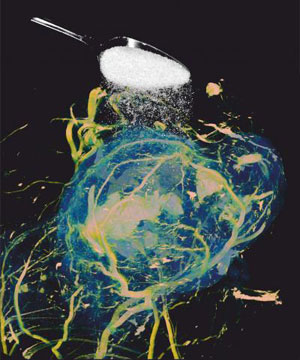 detecting sugar in tumor MRIs