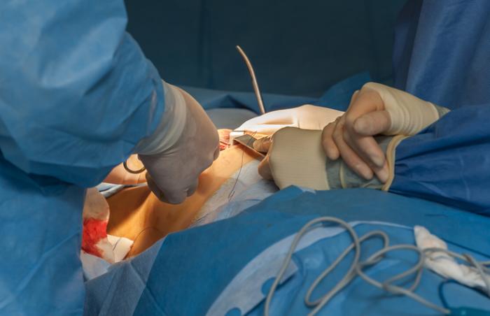 Doctors Conducted Breast Enlargement Surgery Instead of Breast