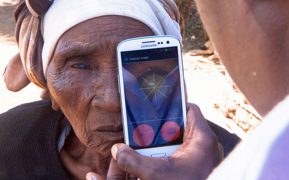 A woman from Nakuru, Kenya, having a cataract scan with the Peek smartphone tool ©Peek