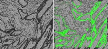 Myelinated fibers in mouse cerebral cortex