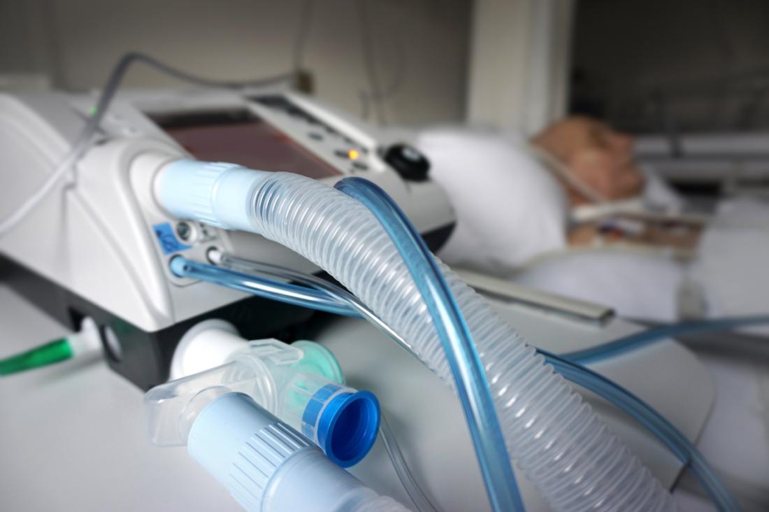 ARDS treatment ICU