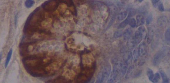Micrograph of intestinal crypts with Paneth cells