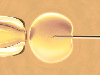 IVF