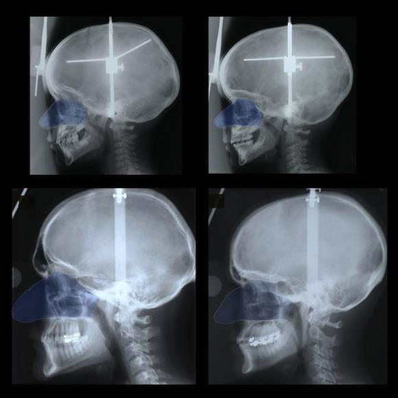 4 scans of skulls - top 2 female, lower 2 male