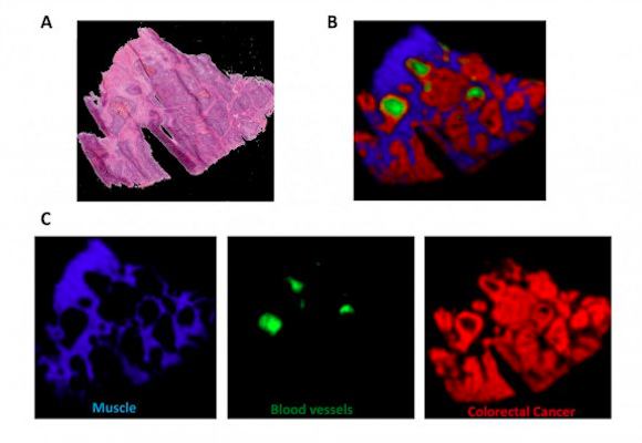 Tissue images using mass spectrometry imaging