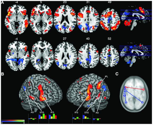 scans of musicians' brains