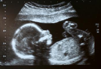 scan of a baby in the womb