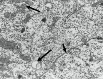 Nuclear Membranes
