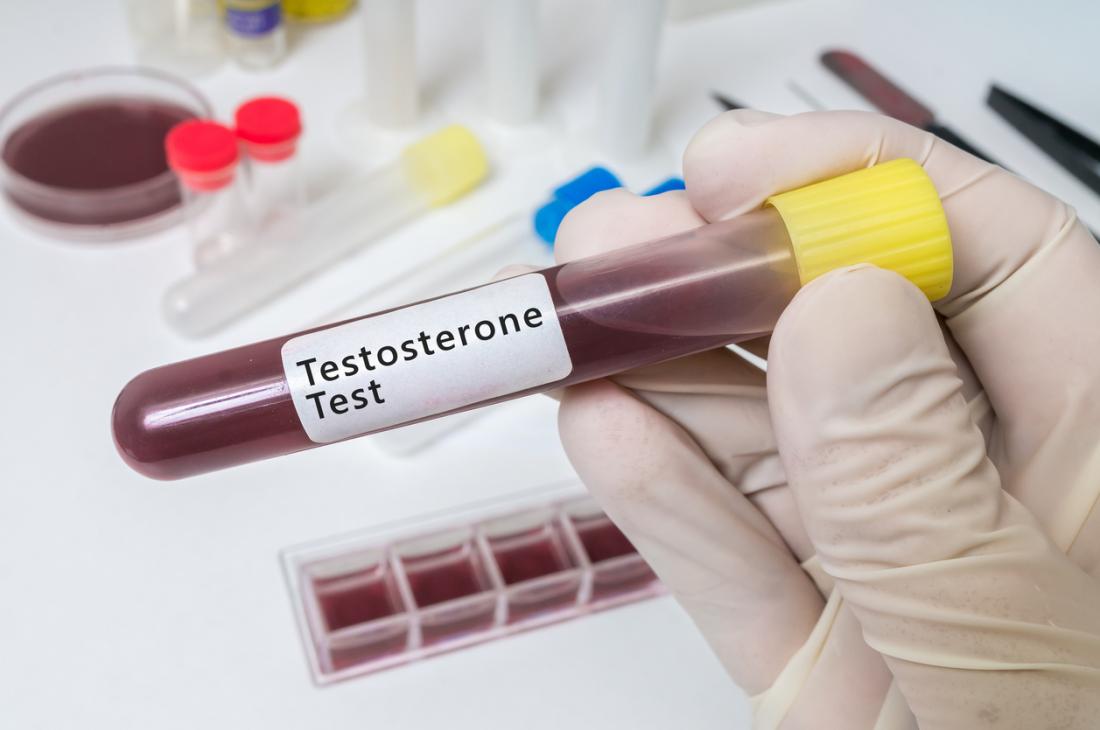 testosterone imbalances