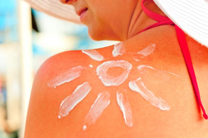 Woman with sunburn