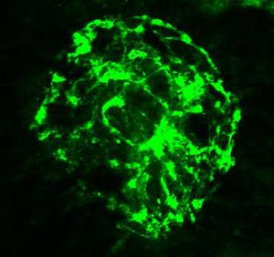 mouse retina responds to injury