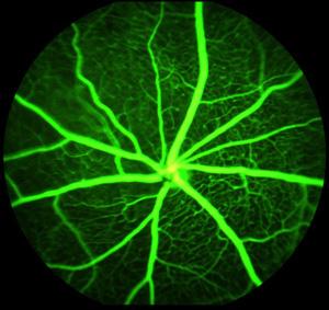 normal blood vessels of a mouse's retina.