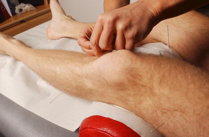 patient receiving acupuncture to the knee