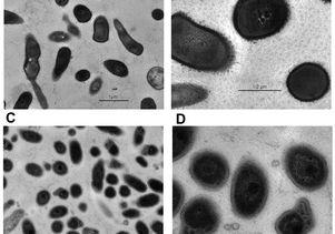 Resveratrol's effects on acne bacteria