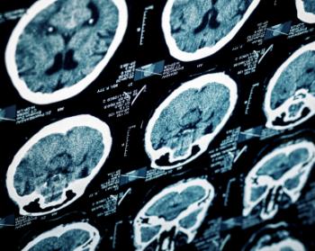 brain scans