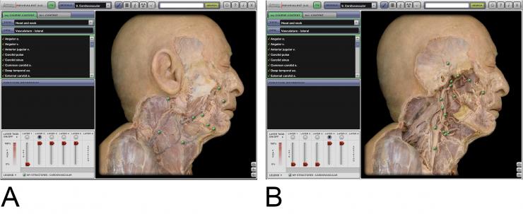 computer simulated anatomy program